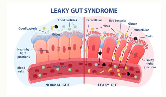 The Gut–Skin Connection: Why Your Skin Is Carrying the Message - The Soap Lab Scotland