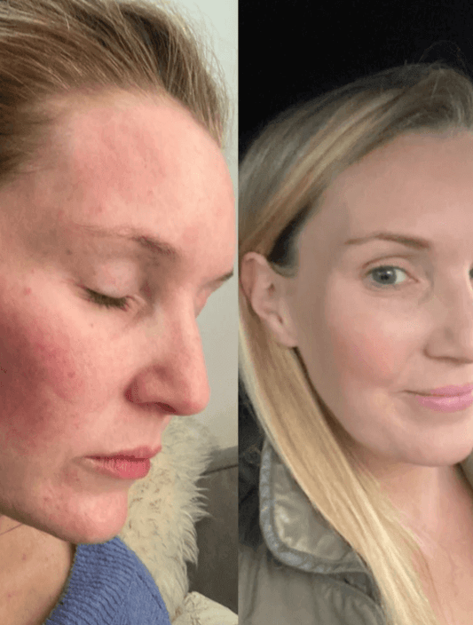 natural face cream 100ml made with coconut and rosehip extracts by white rabbit skincare